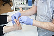 Chiropody Treatment #1 Photograph by Science Photo Library