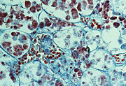 Pituitary Gland #1 Photograph by Science Photo Library
