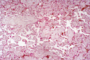 Placenta Section, Lm #1 Photograph by Science Stock Photography