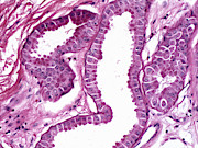 Skin, Apocrine Glands Lm #3 Photograph by Alvin Telser