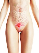 Uterine Cancer #1 Photograph by Science Photo Library