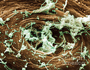 Bacteria On Skin #2 Photograph by David M. Phillips