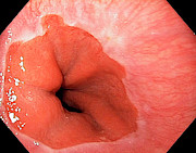 Healthy Cardia Of The Stomach #2 Photograph by Science Photo Library