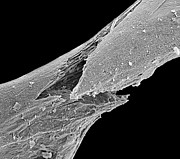 Osteoporotic Bone #2 Photograph by Science Photo Library