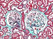 Renal Corpuscle #2 Photograph by Science Photo Library