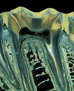 Tooth #2 Photograph by Science Photo Library