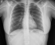 Normal Healthy Chest X-ray #3 Photograph by Science Photo Library