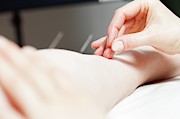 Acupuncture Treatment #4 Photograph by Science Photo Library