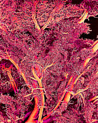Blood Vessels #4 Photograph by Science Photo Library