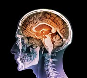 Human Head #6 Photograph by Science Photo Library