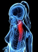 Back Pain, Conceptual Artwork #67 Digital Art by Sciepro
