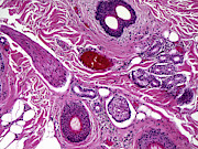 Skin, Lm #8 Photograph by Alvin Telser