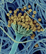 Aspergillus Ustus Hyphae And Structure Photograph by Science Photo Library