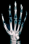 Colorvir X-ray Photo Of Normal Right Hand Photograph by Science Photo Library