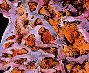 Coloured Sem Of Bone Marrow In Spongy Bone Photograph by Science Photo Library