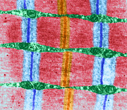 Contracted Skeletal Muscle TEM Photograph by Biophoto Associates