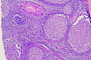 Cross-section Of A Human Salivary Gland Photograph by Science Photo Library