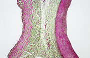 Femoral Vein And Artery Photograph by Science Photo Library