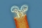 Floscularia Sp. Rotifer Photograph by Science Photo Library