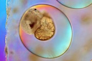 Galba Truncatula Egg With Embryo Photograph by Science Photo Library