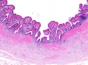 Gall Bladder Photograph by Science Photo Library