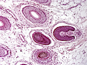 Hair Follicles, Lm Photograph by Alvin Telser