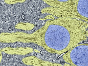 Hippocampus Neuron Photograph by Science Photo Library
