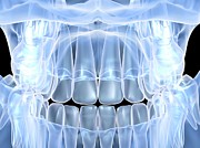 Human Skull With Teeth Photograph by Science Photo Library