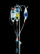Intravenous Drips Photograph by Science Photo Library