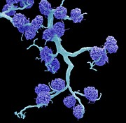 Kidney Glomeruli Photograph by Science Photo Library