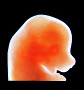 Mouse Embryo Photograph by Science Photo Library