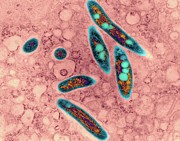 Mycobacterium Avium Lung Infection Photograph by Science Photo Library