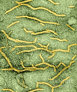 Mycobacterium Tuberculosis #9 Photograph by Kwangshin Kim Mycobacterium Tuberculosis #9 Photograph by Kwangshin Kim