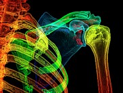 Normal Shoulder Photograph by Science Photo Library