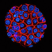 Pancreatic Cancer Cells Photograph by Science Photo Library