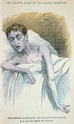 Patient In Typical Cholera Attitude Photograph by Science Photo Library