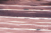 Skeletal Muscle Photograph by Spike Walker / Microworld Services / Dorling Kindersley