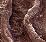 Surface Of Human Vagina Photograph by David M. Phillips