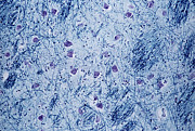 Thalamus Photograph by Science Photo Library