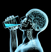 X-ray Of Man And Brain Drinking Photograph by Ikon Ikon Images X-ray Of Man And Brain Drinking Photograph by Ikon Ikon Images