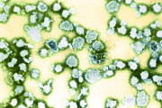 La Crosse Virus #1 Photograph by Science Source La Crosse Virus #1 Photograph by Science Source