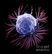 Breast Cancer Cell #2 Photograph by Science Source