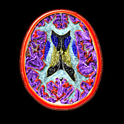 Cross-sectional Mri Of The Human Brain Photograph by Medical Body Scans