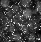 Lyme Disease, Borrelia Burgdorferi Photograph by Science Source Lyme Disease, Borrelia Burgdorferi Photograph by Science Source