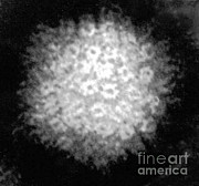 Varicella-zoster Virus Photograph by Science Source