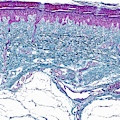 Skin Lm Photograph by Alvin Telser Skin Lm Photograph by Alvin Telser