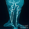 Circle Of Willis Photograph by Susan Leavines Circle Of Willis Photograph by Susan Leavines