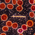 Borrelia Burgdorferi, Lm Photograph by Michael Abbey Borrelia Burgdorferi, Lm Photograph by Michael Abbey