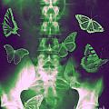 Butterflies in the stomach Photograph by Guy Viner Butterflies in the stomach Photograph by Guy Viner