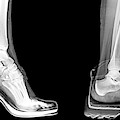 Different Shoes X-ray Photograph by Science Photo Library